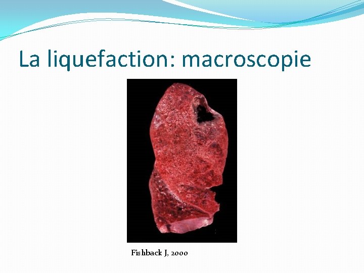 La liquefaction: macroscopie Fishback J, 2000 