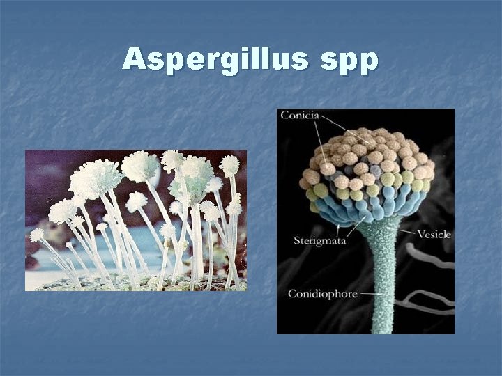 Aspergillus spp 