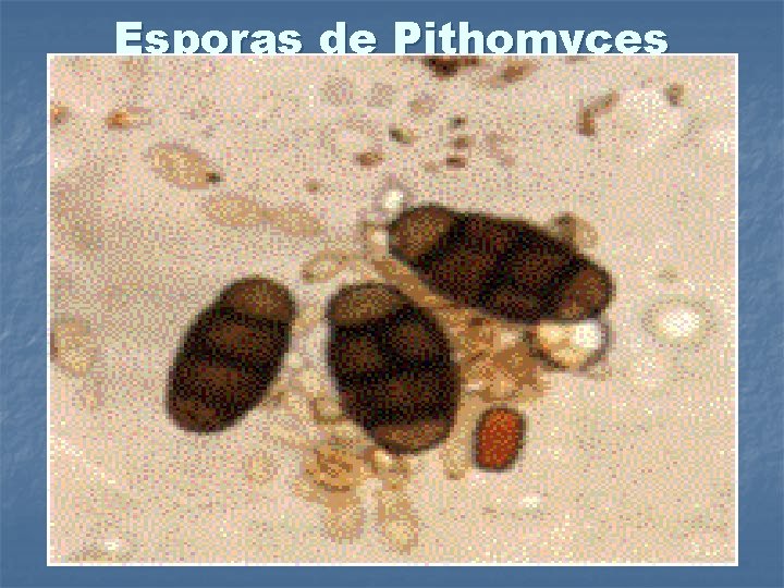 Esporas de Pithomyces chartarum 