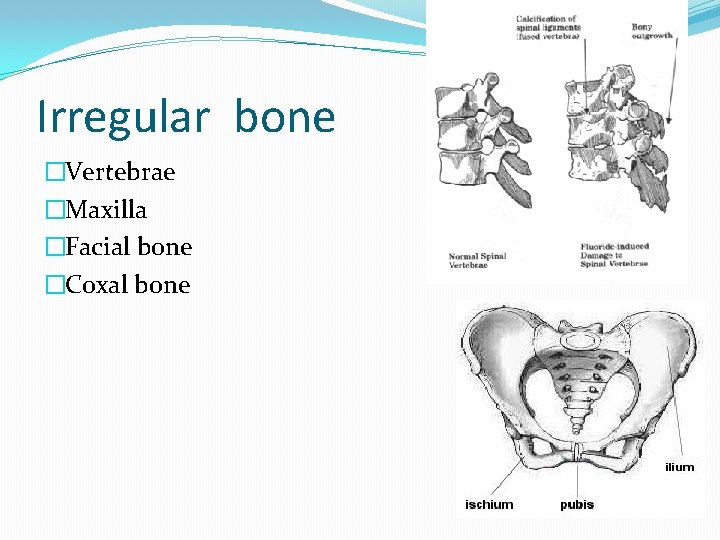 Irregular bone �Vertebrae �Maxilla �Facial bone �Coxal bone 