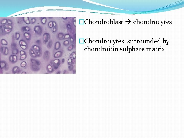 �Chondroblast chondrocytes �Chondrocytes surrounded by chondroitin sulphate matrix 