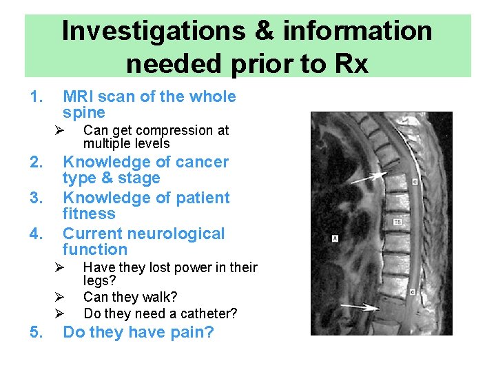 Investigations & information needed prior to Rx 1. MRI scan of the whole spine