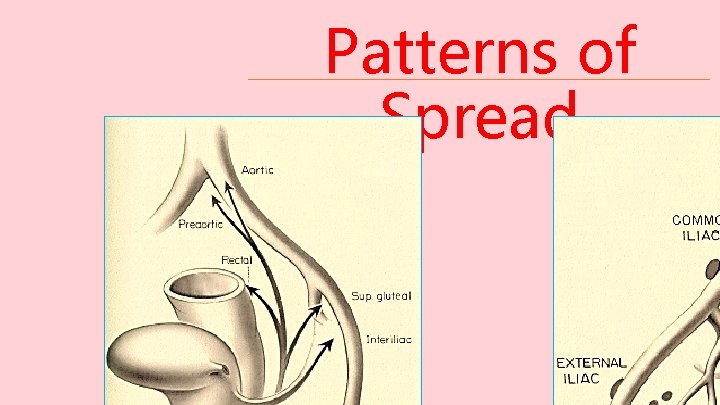 Patterns of Spread 