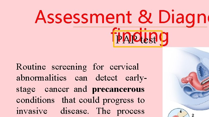 Assessment & Diagno finding PAP test Routine screening for cervical abnormalities can detect earlystage