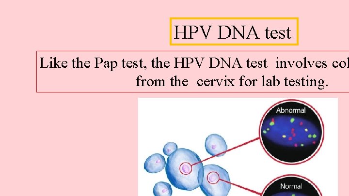 HPV DNA test Like the Pap test, the HPV DNA test involves col from