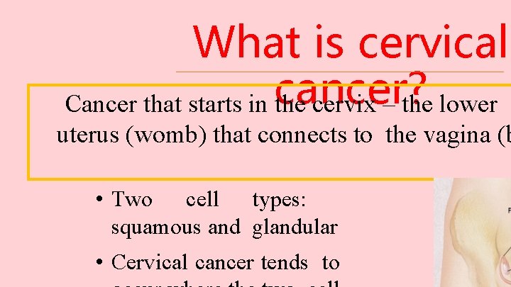 What is cervical Cancer that starts in cancer? the cervix – the lower p