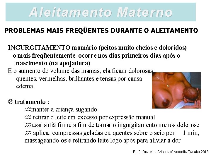 Aleitamento Materno PROBLEMAS MAIS FREQÜENTES DURANTE O ALEITAMENTO INGURGITAMENTO mamário (peitos muito cheios e