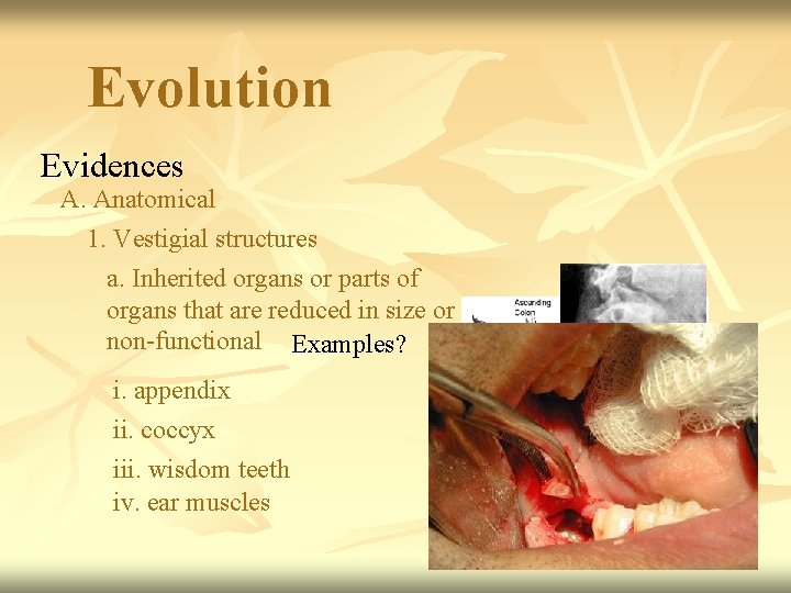 Evolution Evidences A. Anatomical 1. Vestigial structures a. Inherited organs or parts of organs