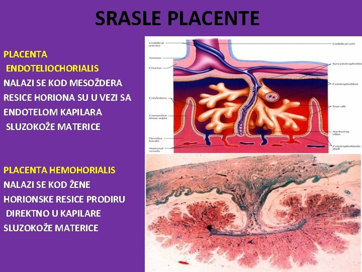 SRASLE PLACENTA ENDOTELIOCHORIALIS NALAZI SE KOD MESOŽDERA RESICE HORIONA SU U VEZI SA ENDOTELOM