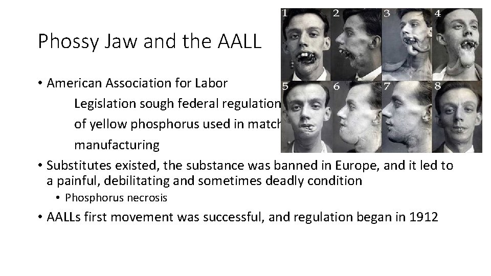 Phossy Jaw and the AALL • American Association for Labor Legislation sough federal regulation