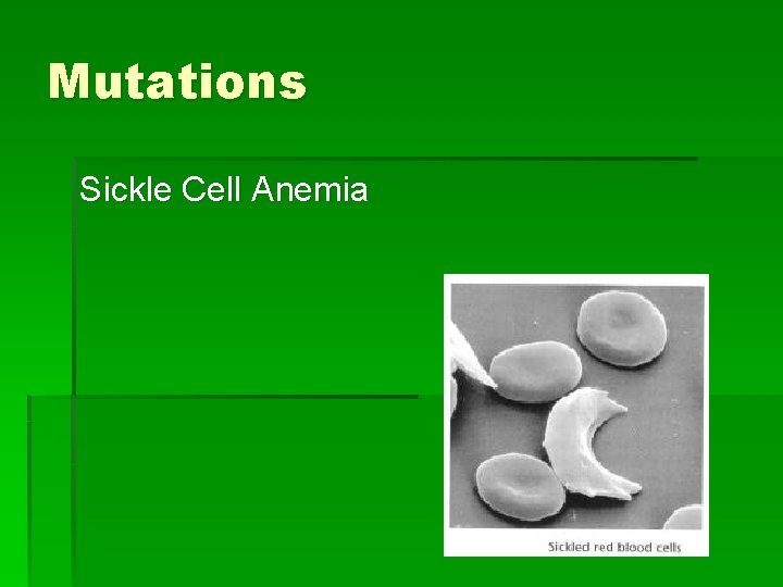 Mutations Sickle Cell Anemia 