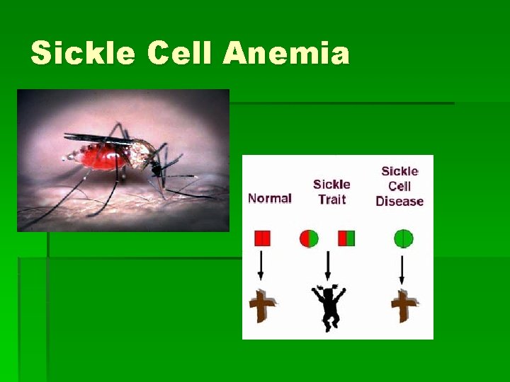 Sickle Cell Anemia 
