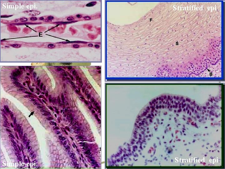 Simple epi. Stratified epi. 