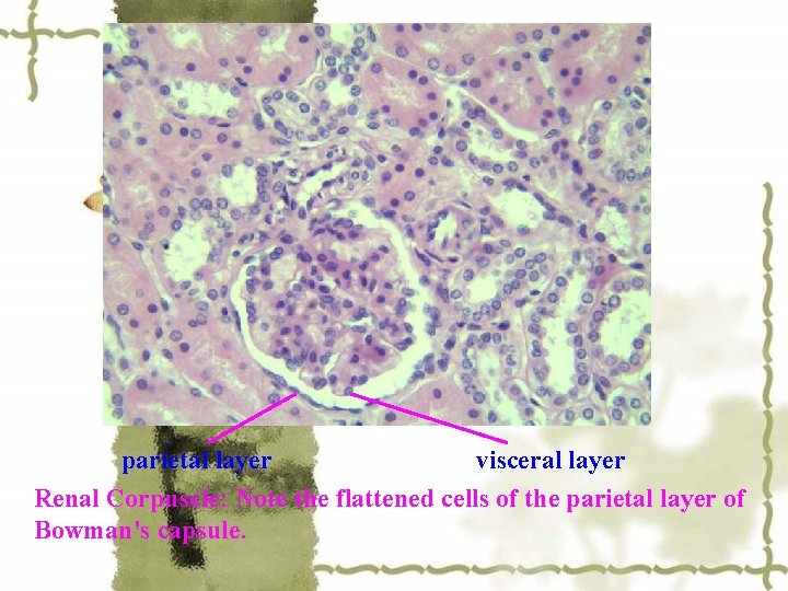 parietal layer visceral layer Renal Corpuscle: Note the flattened cells of the parietal layer