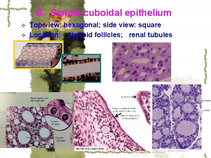 B. Simple cuboidal epithelium v v Top view: hexagonal; side view: square Location: thyroid