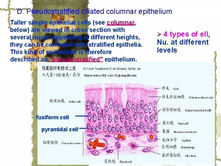 D. Pseudostratified ciliated columnar epithelium Taller simple epithelial cells (see columnar, below) are viewed