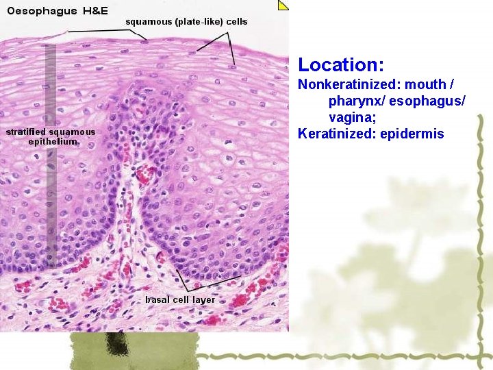 Location: Nonkeratinized: mouth / pharynx/ esophagus/ vagina; Keratinized: epidermis 