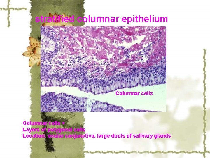 stratified columnar epithelium Columnar cells + Layers of polygonal cells Location: ocular conjunctiva, large