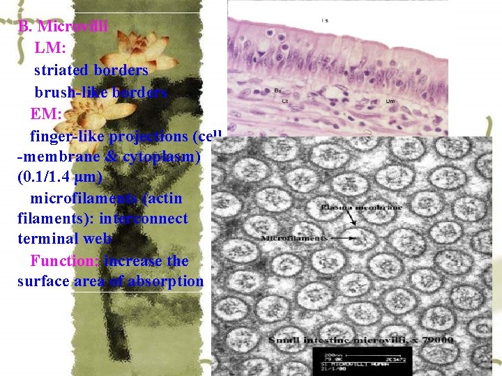 B. Microvilli LM: striated borders brush-like borders EM: finger-like projections (cell -membrane & cytoplasm)