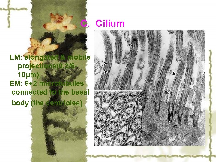 C. Cilium LM: elongated & mobile projections(0. 2/510μm); EM: 9+2 microtubules connected to the