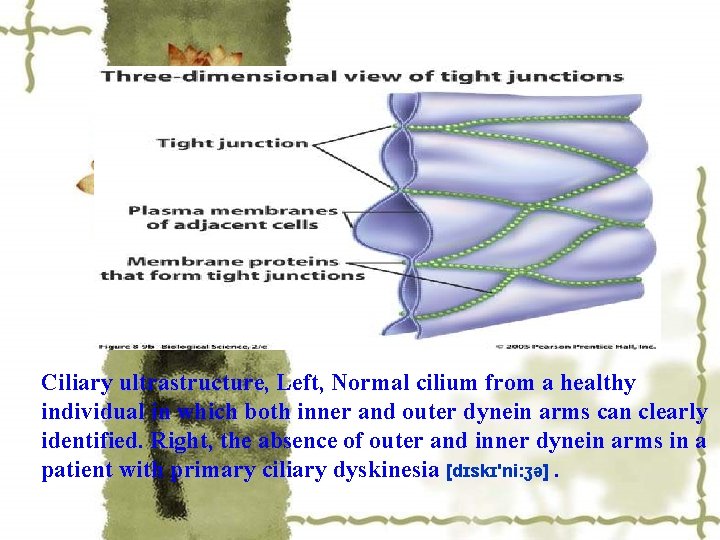 Ciliary ultrastructure, Left, Normal cilium from a healthy individual in which both inner and