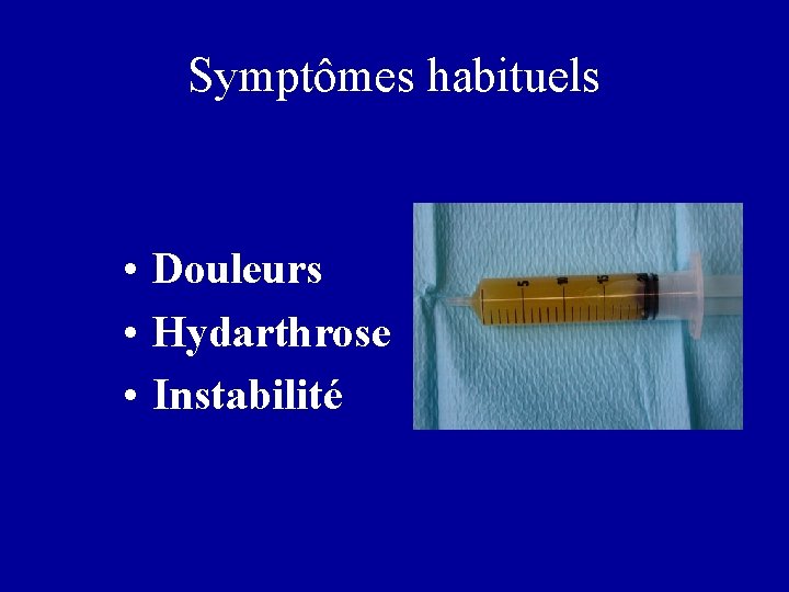 Symptômes habituels • Douleurs • Hydarthrose • Instabilité 