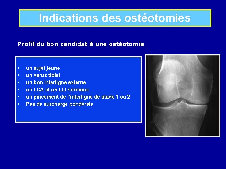 Indications des ostéotomies Profil du bon candidat à une ostéotomie • • • un