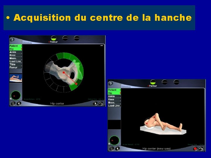  • Acquisition du centre de la hanche 