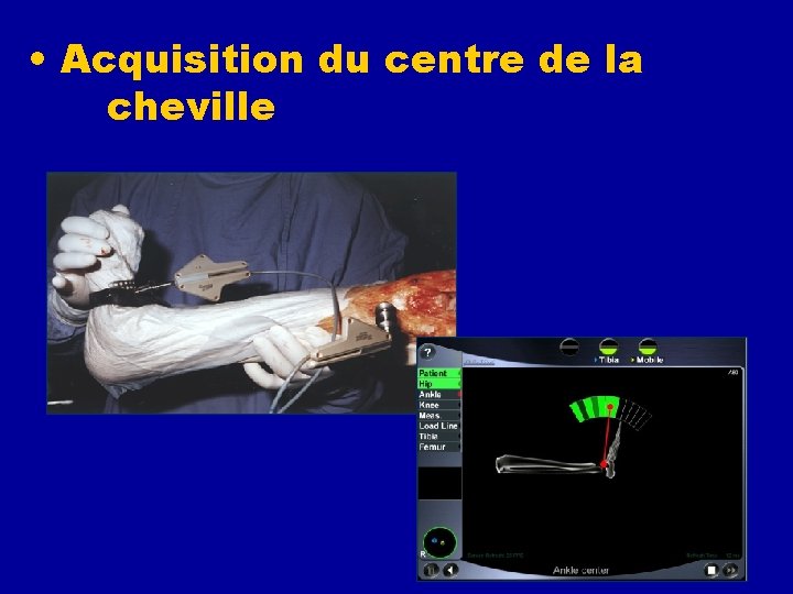  • Acquisition du centre de la cheville 