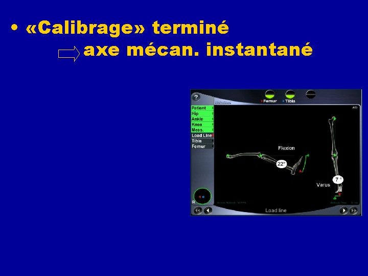  • «Calibrage» terminé axe mécan. instantané • De face et de profil •