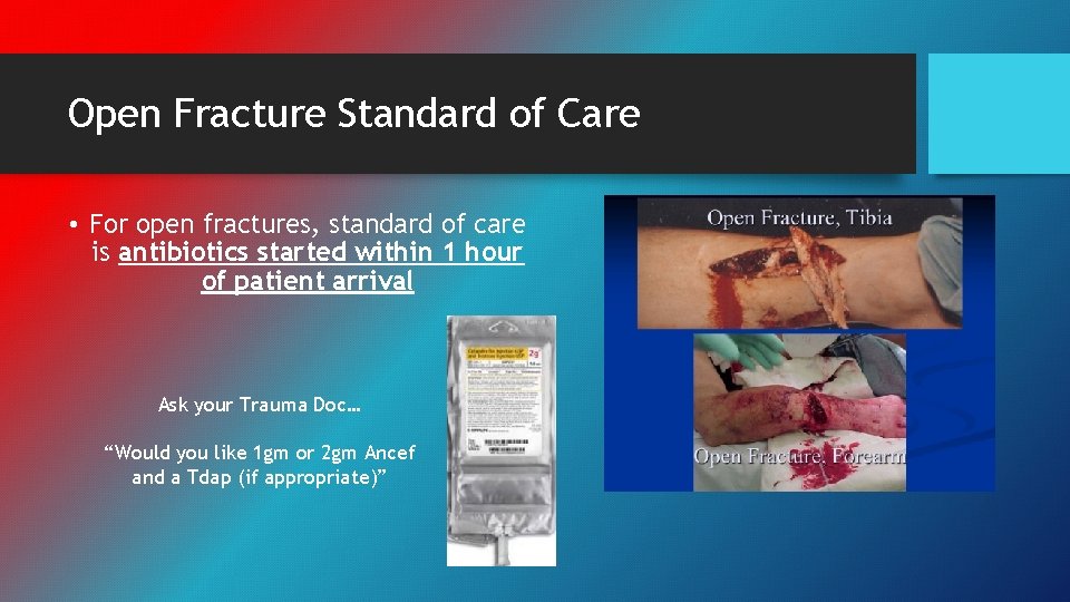 Open Fracture Standard of Care • For open fractures, standard of care is antibiotics