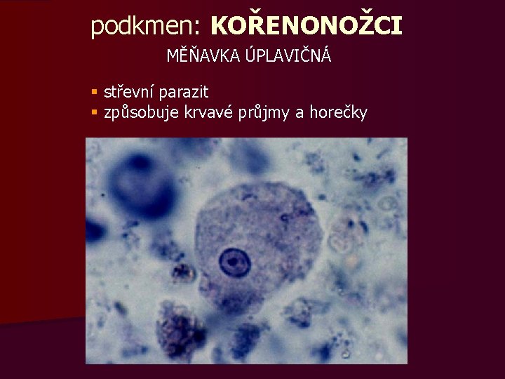 podkmen: KOŘENONOŽCI MĚŇAVKA ÚPLAVIČNÁ § střevní parazit § způsobuje krvavé průjmy a horečky 