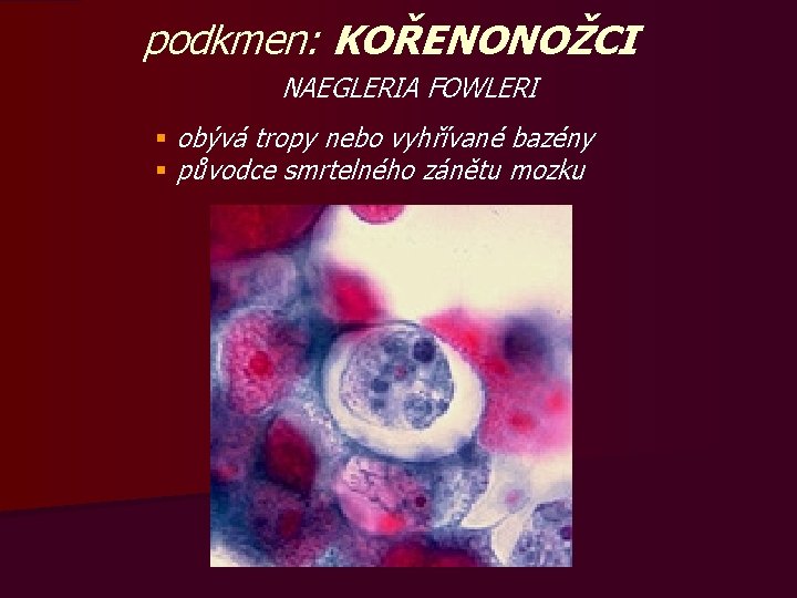 podkmen: KOŘENONOŽCI NAEGLERIA FOWLERI § obývá tropy nebo vyhřívané bazény § původce smrtelného zánětu