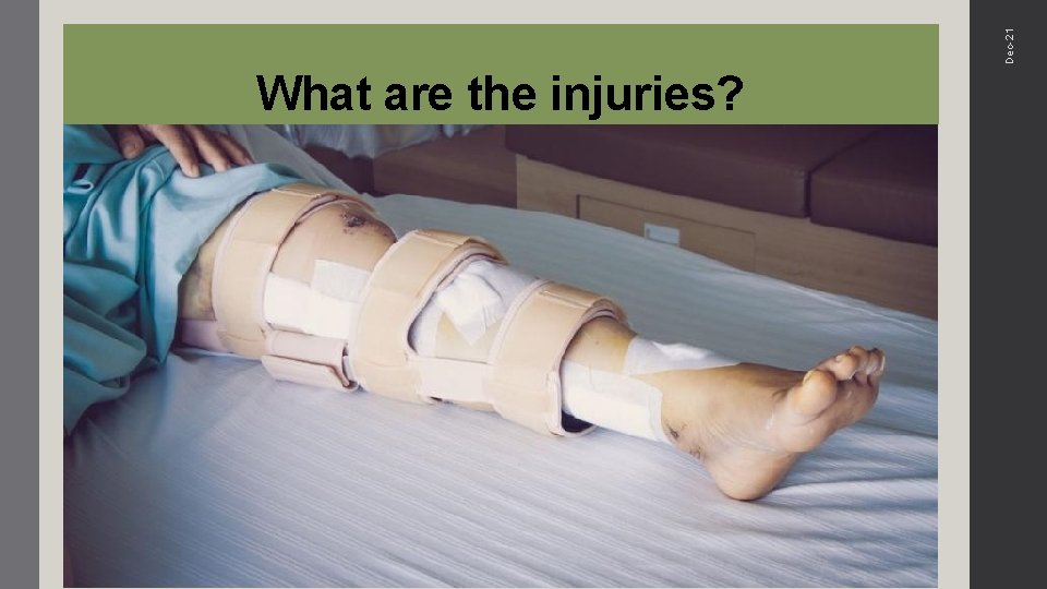 Dec-21 What are the injuries? 
