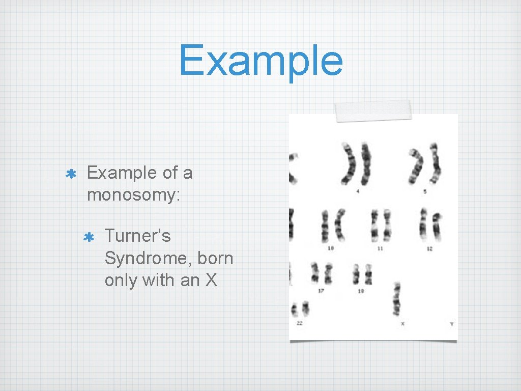 Example of a monosomy: Turner’s Syndrome, born only with an X 