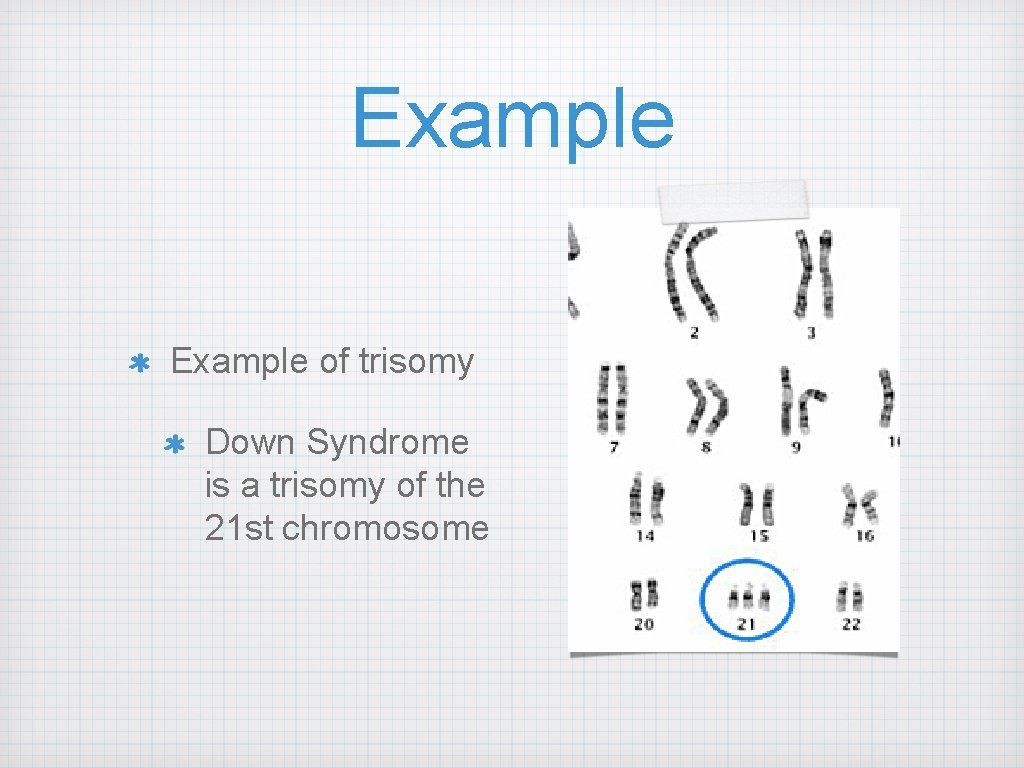 Example of trisomy Down Syndrome is a trisomy of the 21 st chromosome 