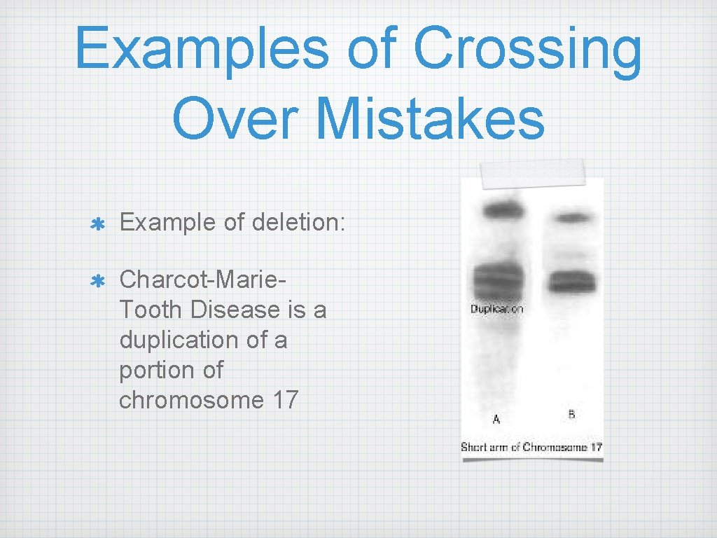 Examples of Crossing Over Mistakes Example of deletion: Charcot-Marie. Tooth Disease is a duplication