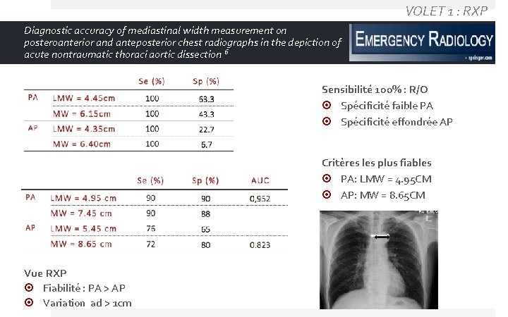 VOLET 1 : RXP Diagnostic accuracy of mediastinal width measurement on posteroanterior and anteposterior