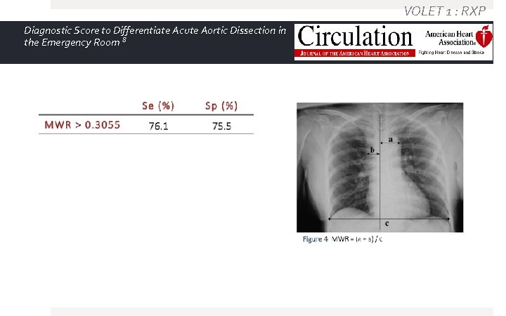 VOLET 1 : RXP Diagnostic Score to Differentiate Acute Aortic Dissection in the Emergency