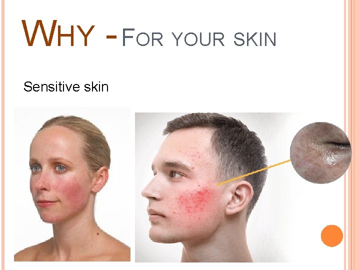 WHY - FOR YOUR SKIN Sensitive skin 