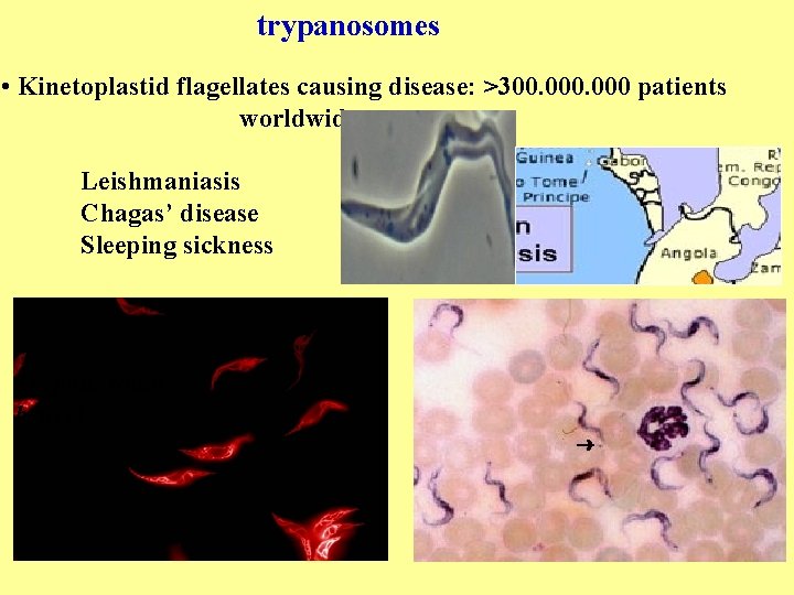 trypanosomes • Kinetoplastid flagellates causing disease: >300. 000 patients worldwide Leishmaniasis Chagas’ disease Sleeping