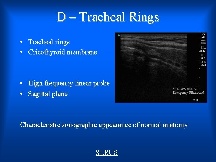 D – Tracheal Rings • Tracheal rings • Cricothyroid membrane • High frequency linear
