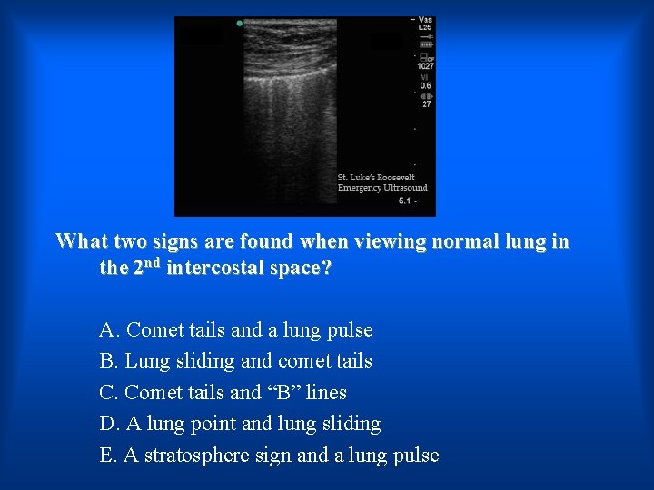 What two signs are found when viewing normal lung in the 2 nd intercostal