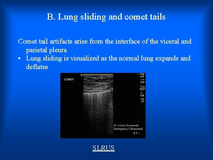B. Lung sliding and comet tails Comet tail artifacts arise from the interface of