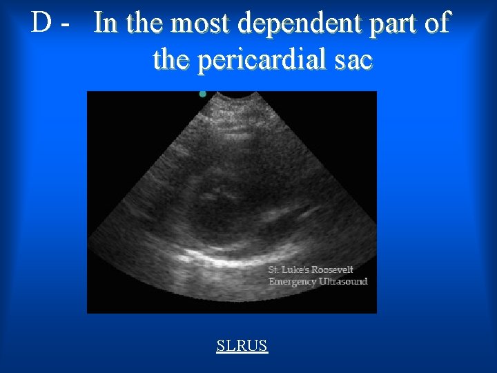 D - In the most dependent part of the pericardial sac SLRUS 