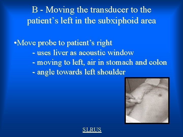 B - Moving the transducer to the patient’s left in the subxiphoid area •