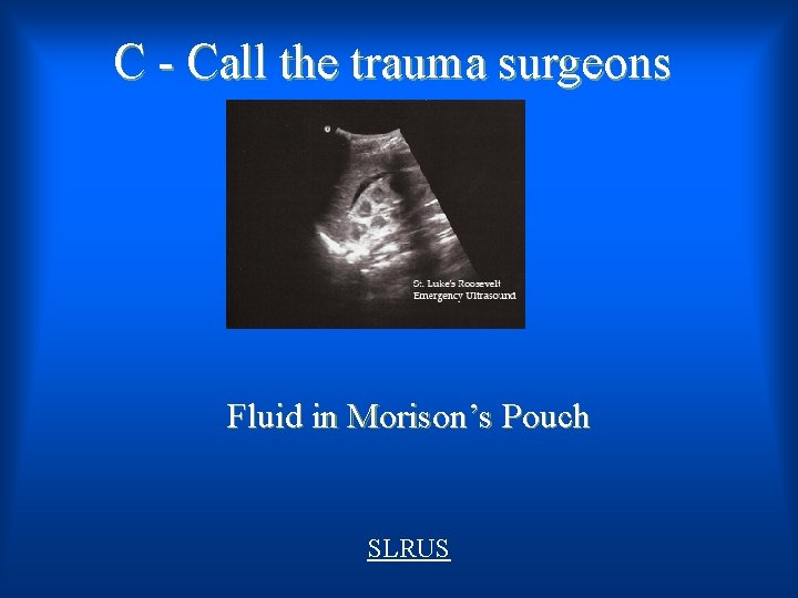 C - Call the trauma surgeons Fluid in Morison’s Pouch SLRUS 