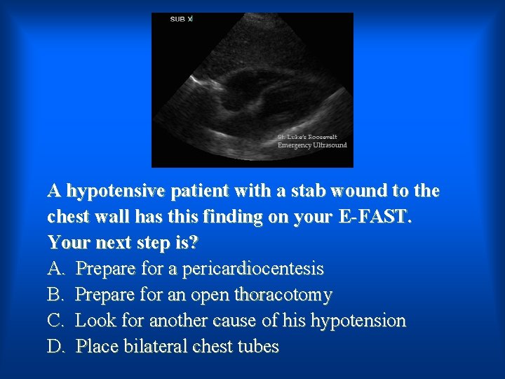A hypotensive patient with a stab wound to the chest wall has this finding