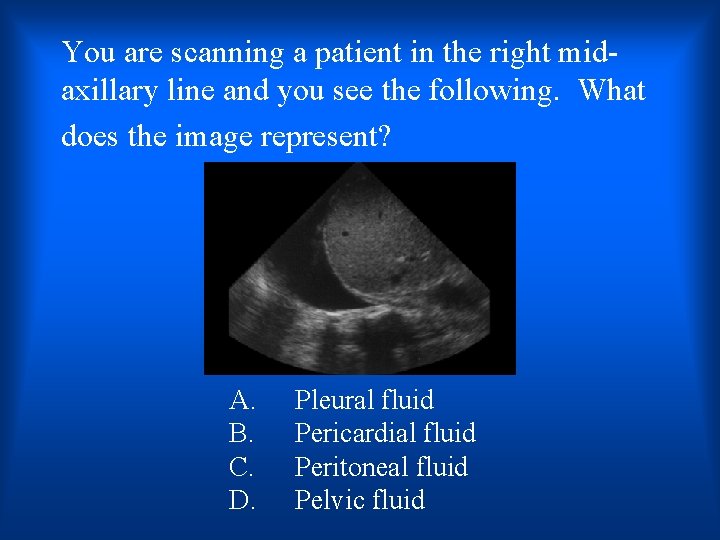 You are scanning a patient in the right midaxillary line and you see the