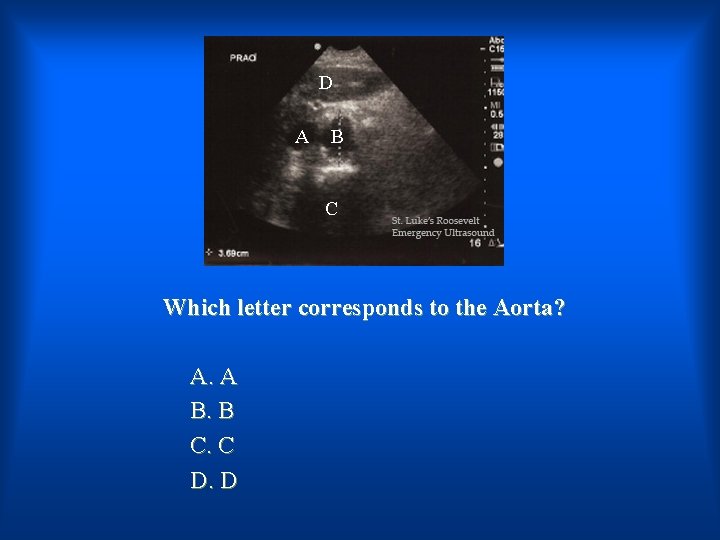 D A B C Which letter corresponds to the Aorta? A. A B. B